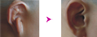 -ǰ(du)