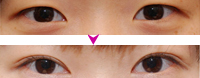 ۲-۲ǰ(du)
